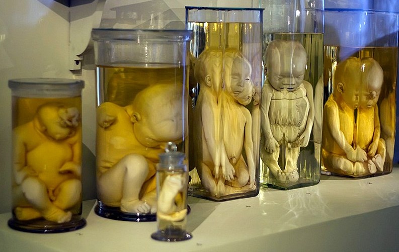 Yuxularınızı qaçıracaq — Dünyanın ən qorxulu 10 MUZEYİ