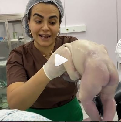 Bakıda  həkim qadını canlı yayımda doğuzdurdu (18+VİDEO)