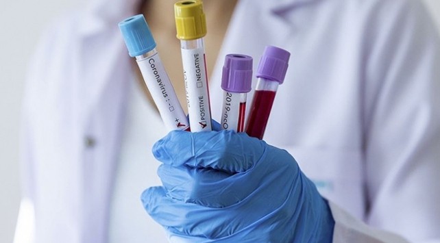 TƏHLÜKƏ: İranda virusdan ölənlərin sayı artır