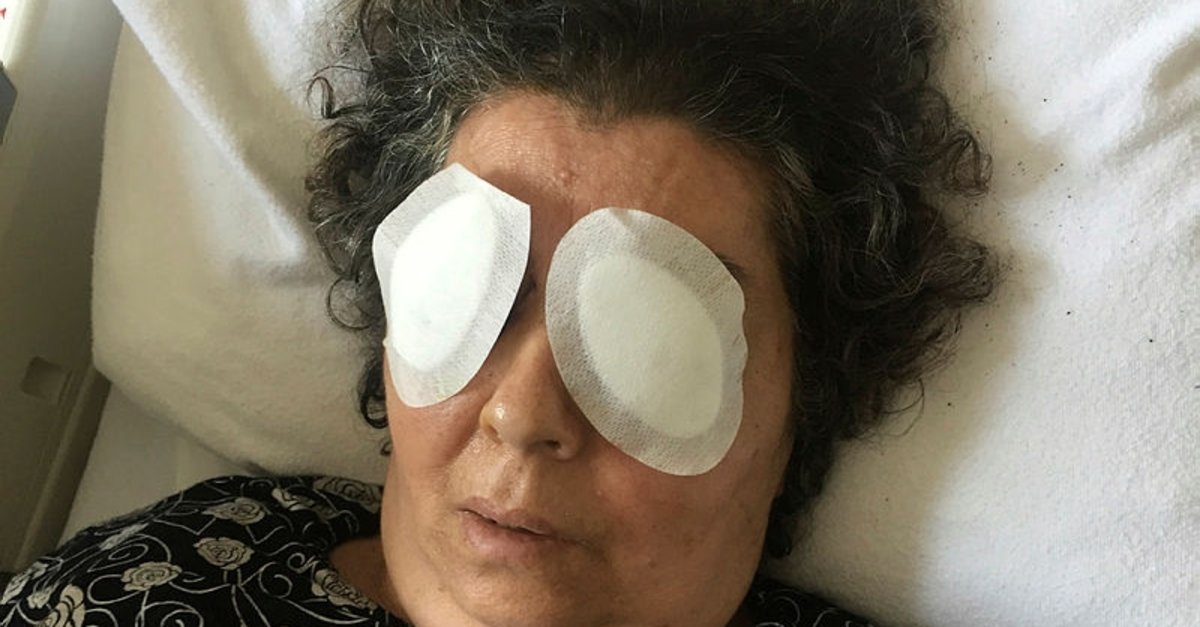 Ruhi xəstə onunla palatada yatan qadının gözünü çıxardı  —  ŞOK   VİDEO