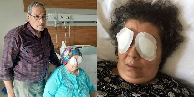 Qadının gözlərini çıxarıb yedi - ŞOK  VİDEO