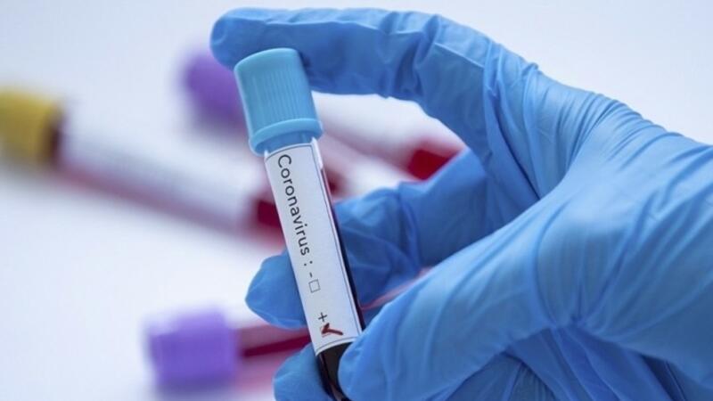 Daha üç azərbaycanlıda koronavirus AŞKARLANDI