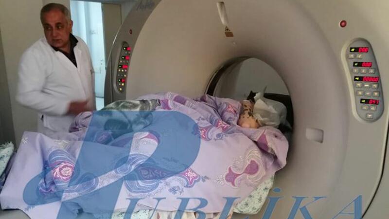 Bakıda özünü binadan atan feminist qızın xəstəxanadan görüntüləri - FOTO