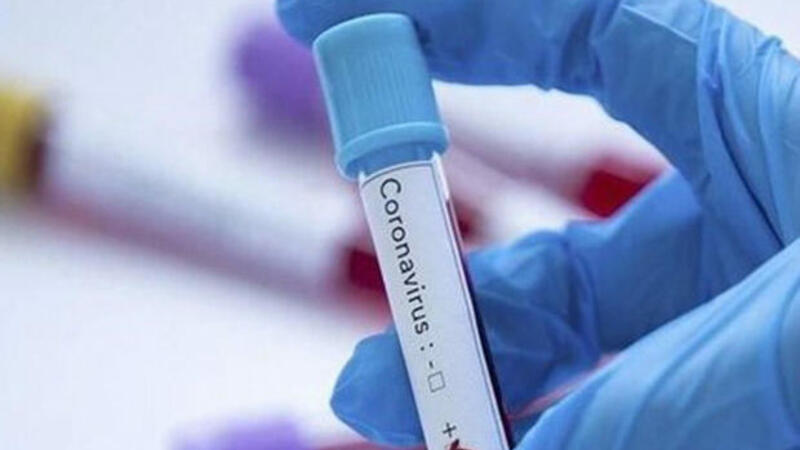 Azərbaycanda daha dörd nəfərdə koronavirus aşkarlandı