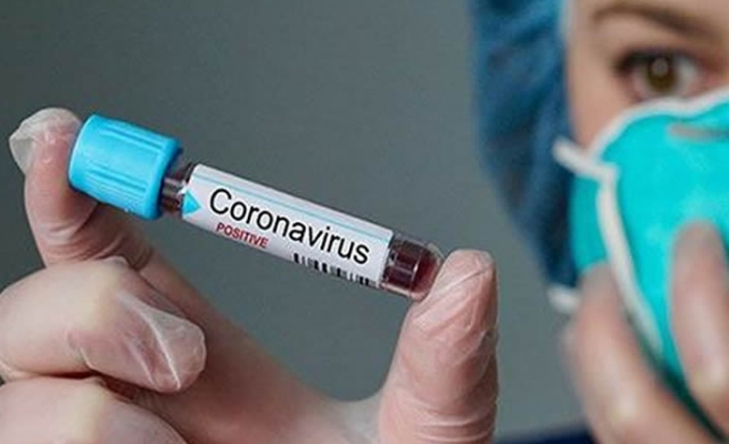 Bir işçi koronavirusa yoluxsa, bütün işçilər karantinə alınacaq - ŞİRKƏTLƏRİN NƏZƏRİNƏ!
