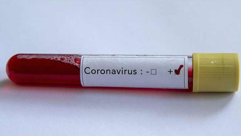 Koronavirus hava yolu ilə yoluxur? - AÇIQLAMA