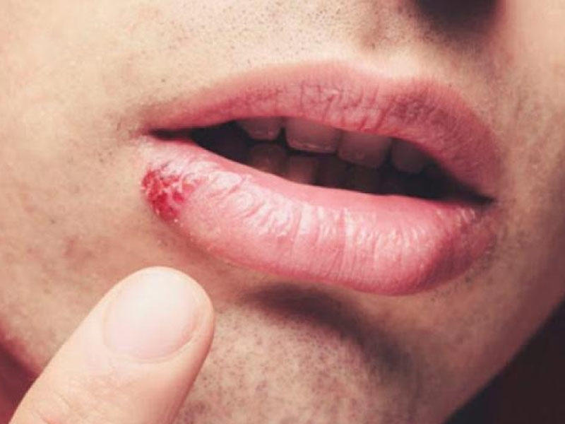 \\\"Koronavirus bədənimizdə herpes kimi əbədi qalsa,insanlıq böyük təhlükədə olacaq\\\" - Rusiyalı patoloqanotom
