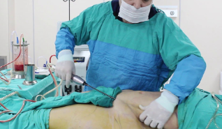 Bakıda ŞOK OLAY - Həkim qadına hamilə olduğunu deməyib onu əməliyyat etdi