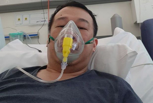 Koronavirusa yoluxduqdan sonra tanınmaz hala düşdü - FOTO