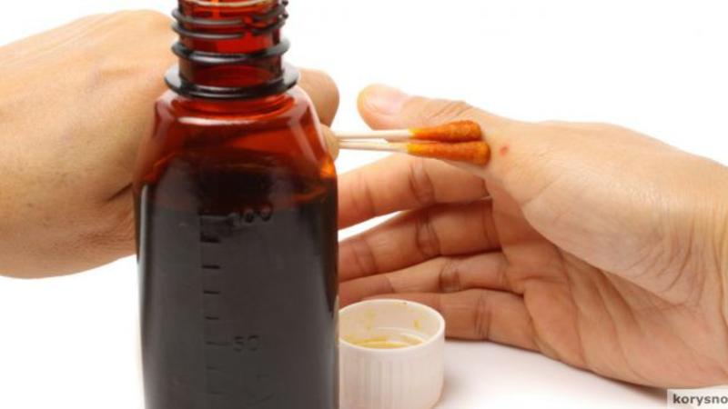 Yod çatışmazlığını evdə bu üsulla yoxlaya bilərsiniz - VİDEO