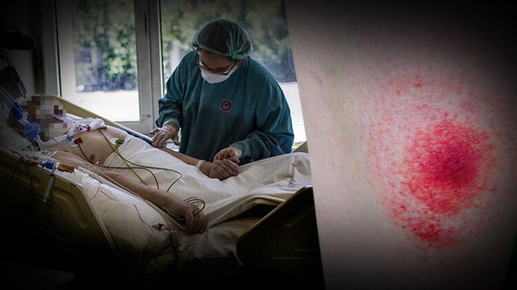 Azərbaycanın qonşusunda yeni dəhşətli virus yayılır - Bu dəfə daha qorxulu...