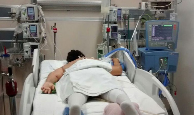 Koronavirus xəstələrini niyə qarın üstə uzandırırlar?