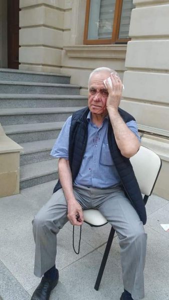 Rəhim Qazıyevə xəsarət yetirən şəxsin kimliyi bəlli oldu