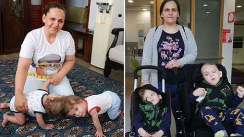 Siyam əkizlərini  başları əməliyyatla ayrıldı - Bir-birlərini gördükdə görün nə etdilər (VİDEO)