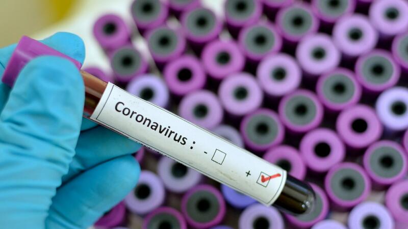 Azərbaycanda daha 471 nəfərdə koronavirus aşkarlandı - 5 nəfər öldü