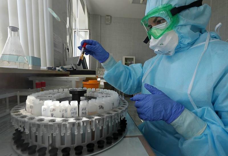 COVID-19 ilə koronavirus infeksiyasının ağır forması temperatur, öskürək və təngənəfəsliklə xarakterizə olunur.