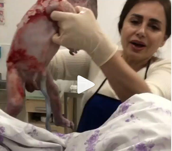 Bakıda biabırçılıq! Həkim qadının doğuş anını paylaşdı (18+VİDEO)