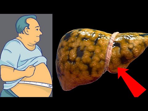 Kök insanlar izləsin - Qaraciyəriniz bu haldadır