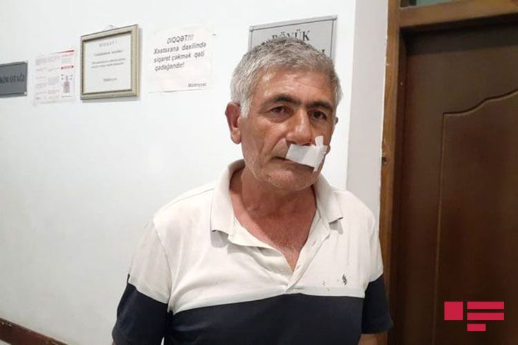 Xalq Artistinin qardaşını döydülər - Foto