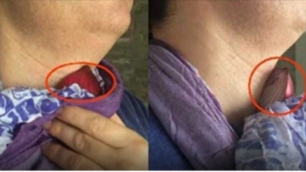 Boyuna soğan bağlamağın inanılmaz faydaları