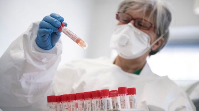Azərbaycanda koronavirusa yoluxma yenidən kəskin artdı