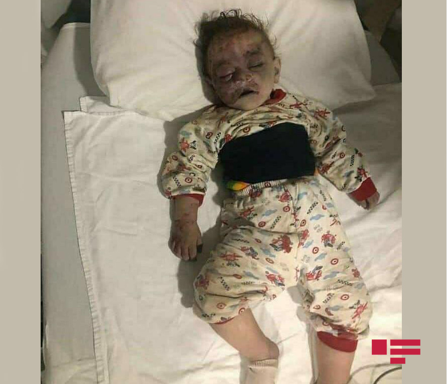 Ermənilər Gəncədə terror törətdi: Ölənlər arasında uşaqlar da var - Video