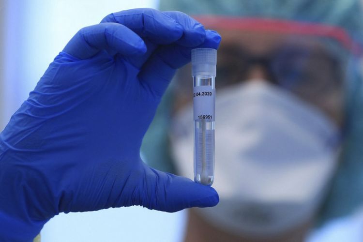 Ermənilər sürətlə qırılır: Koronavirus tüğyan edir