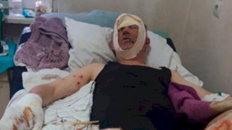 Erməni polkovnik Naftalanda müalicə olunur - FOTO