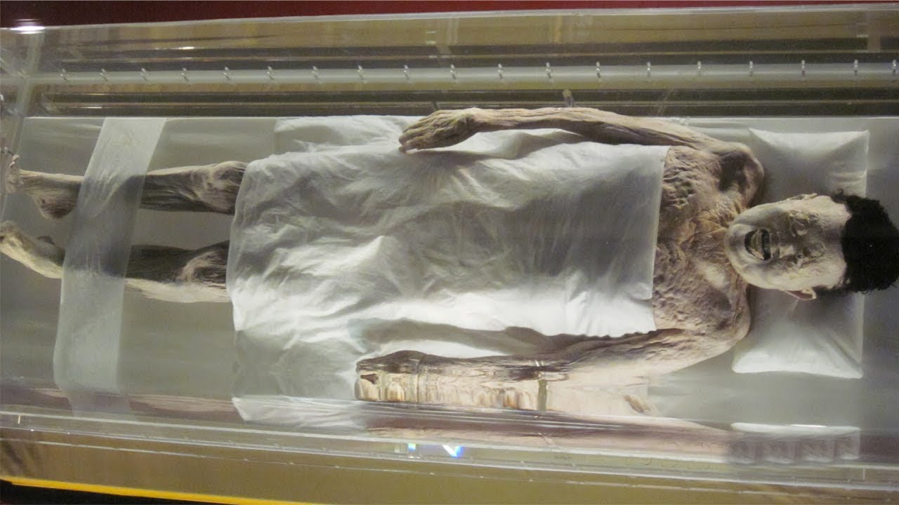 Görüntülər şok etdi: Meyit sağ qaldı (18+VİDEO)