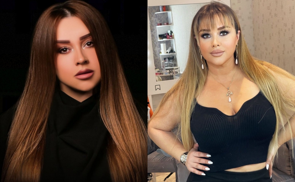 Xatirə İslam elə şəkil paylaşdı ki....