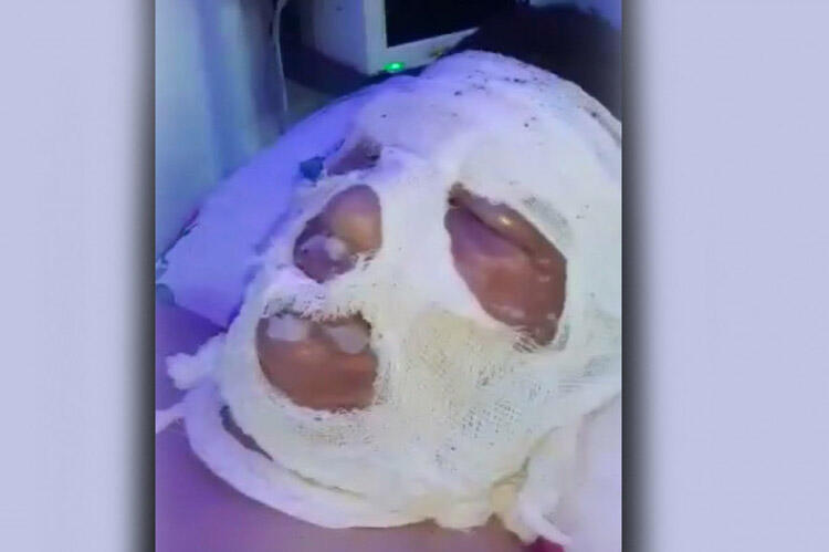 Lənkəranda evə qaz sızıb, partlayış olub, 14 yaşlı şagird xəsarət alıb - FOTO