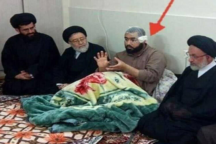 İranda mollanın qulağını kəsdilər