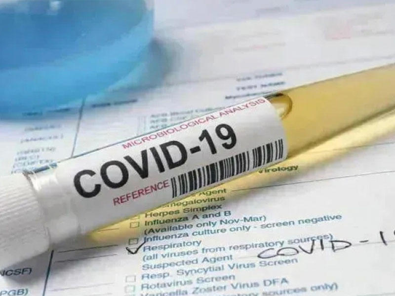 Yay aylarında Azərbaycanda koronavirusun güclü dalğası gözlənilir - Gürcü ekspert
