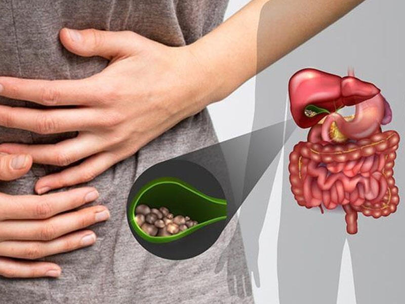 Öd kisəmizi necə “işlədək”, ödün düşməni nədir? - Həkimdən AÇIQLAMA