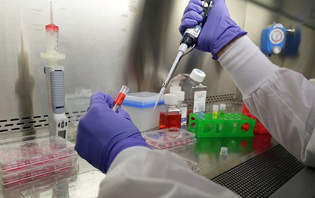 Rusiyada Meymun Çiçəyi Xəstəliyi İlə İlk Hal Təsdiqləndi