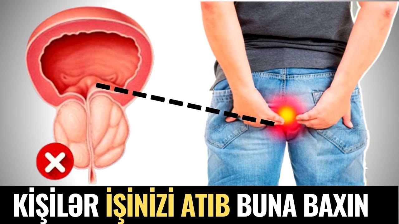Kişilərin 90%-i Bunu Bilmir - iNTİM ƏLAQƏ ZAMANI AĞRI... MÜTLƏQ İZLƏSİN!