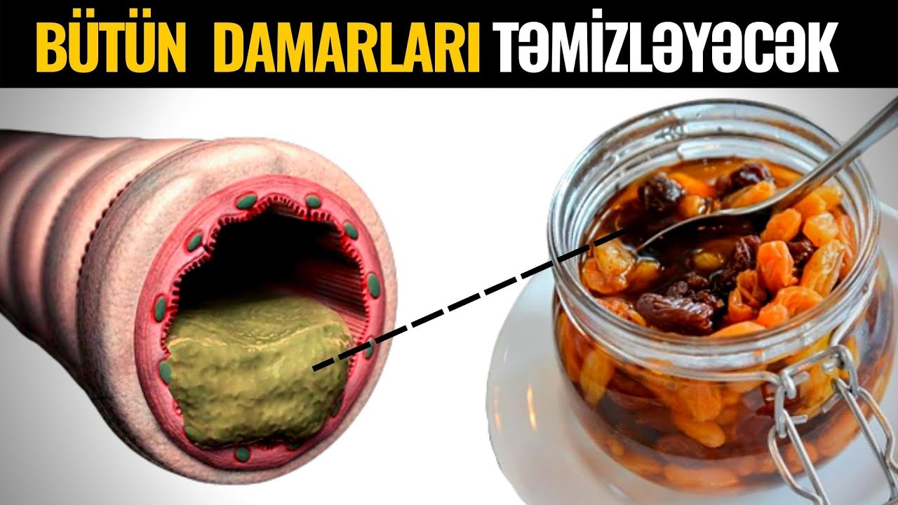 Axşam Hazırlayıb SƏHƏR İÇİN - Qaraciyəri, Damarlardakı Xolesterini TƏMİZLƏYİR