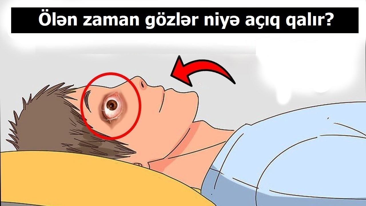 Ölən zaman insanın gözləri niyə açıq qalır? - AÇIQLANDI