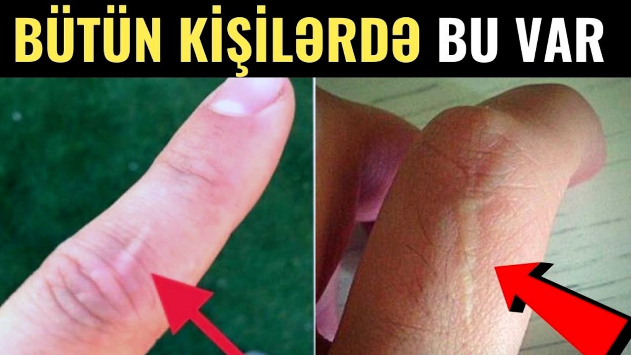 90 FAİZ KİŞİDƏ VAR - Sən Demə Bu Ləkə...(VİDEO)