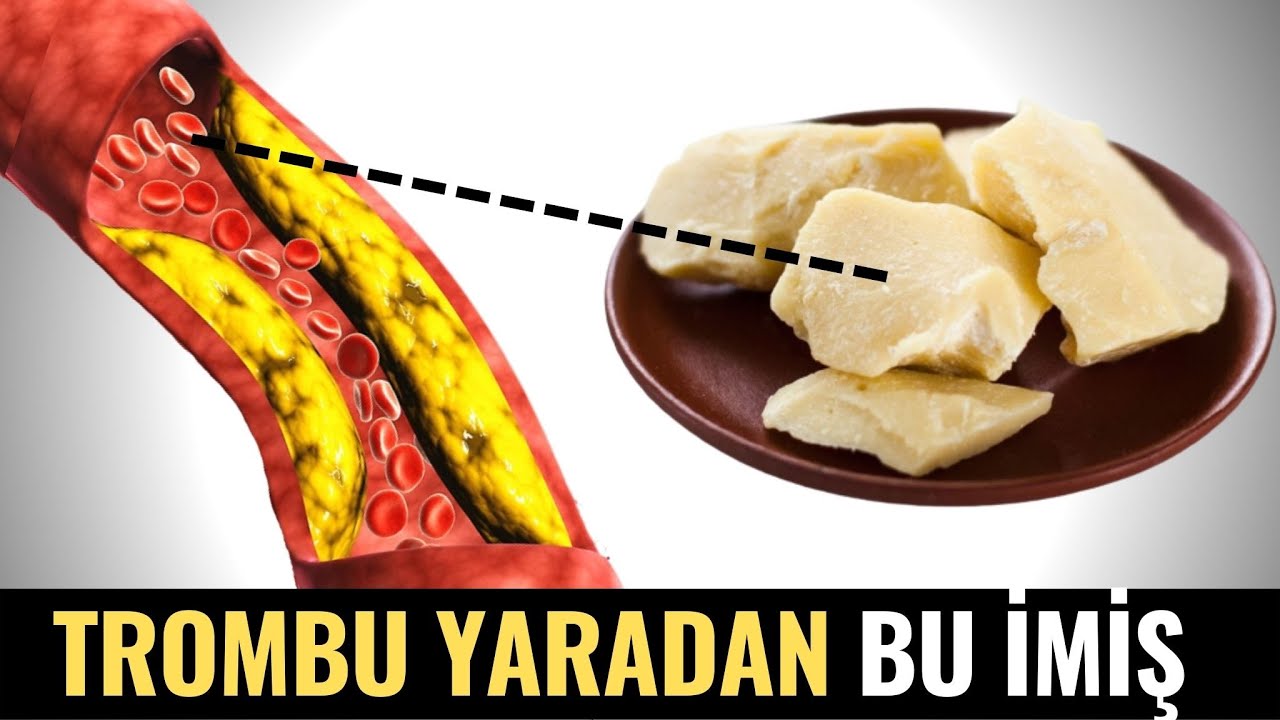 Bu Qidanı Yeyən Kimi QAN LAXTALANIR - DİQQƏT!