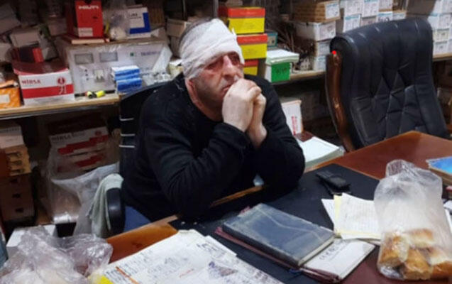 “Sədərək”də sahibkarı döyüb 30 min aparan şəxs tutuldu - FOTO