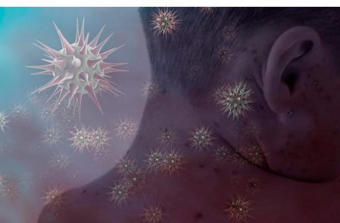 \\\"COVİD\\\"-19-dan sonra yeni virus yayılır — 3 nəfərdən birini öldürür
