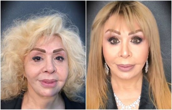 Ruhəngiz Allahverdiyevanın görün neçə yaşı var imiş 