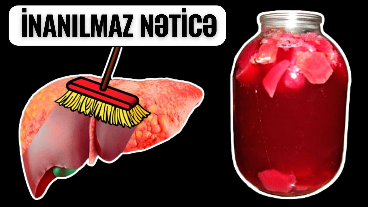 Qaraciyər, Təzyiq və Qəbizliyin Çarəsi - 1 Saata Sağaldır!