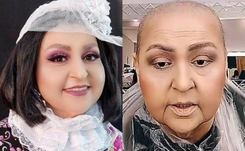 \\\"Toppuş bacı\\\"ya tətbiq olunan immunoterapiya xərçəngi tam sağaldır? – Onkoloqdan AÇIQLAMA