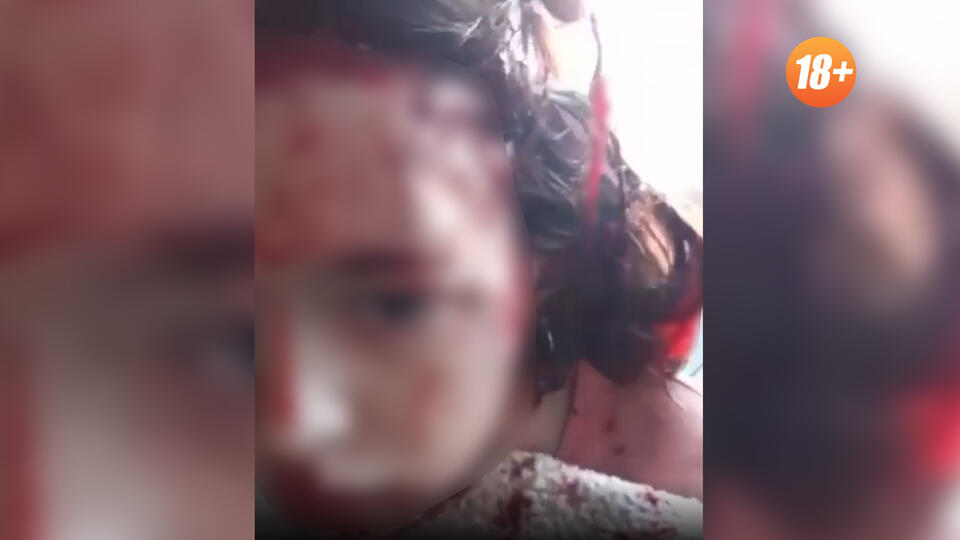 İt uşağın dərisini soydu - FOTO