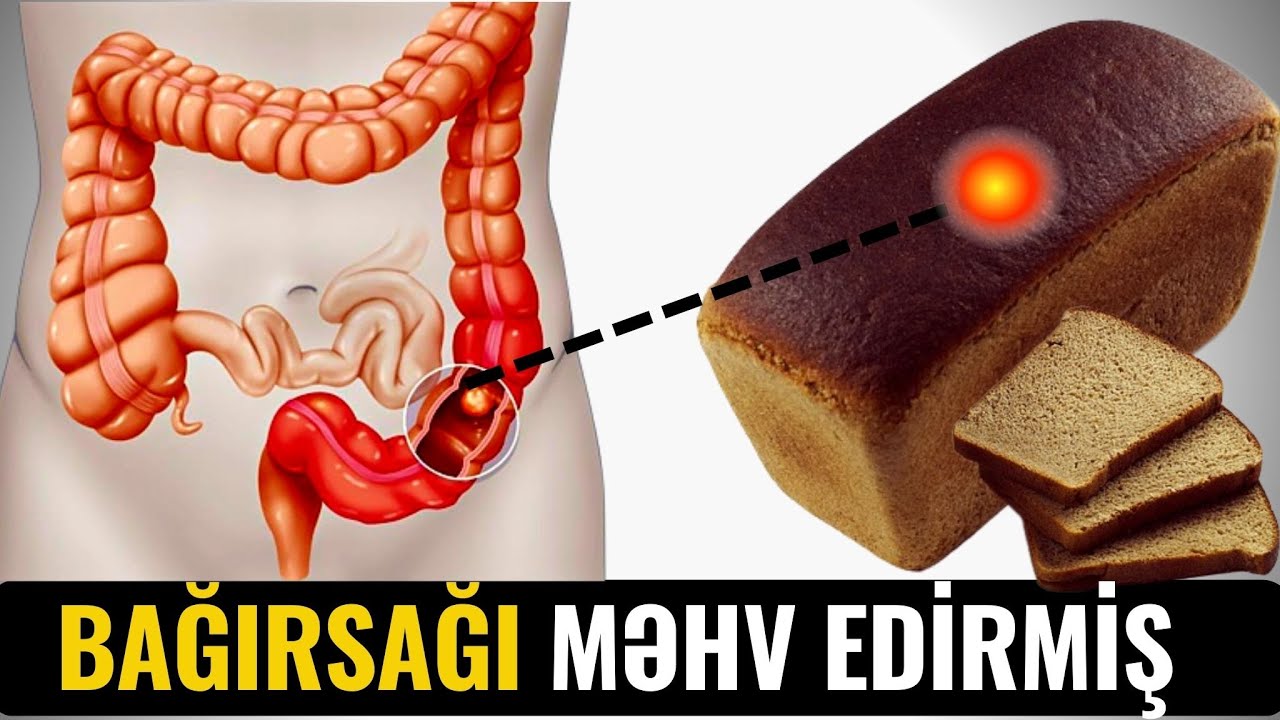 Bağırsaq xəstəliklərinin səbəbi çörəkdəki... - NİYƏ GİZLƏDİRLƏR?
