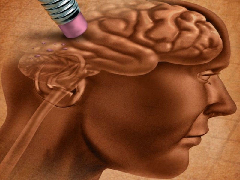 Nevroloq erkən demensiyanın ilk əlamətini – AÇIQLADI