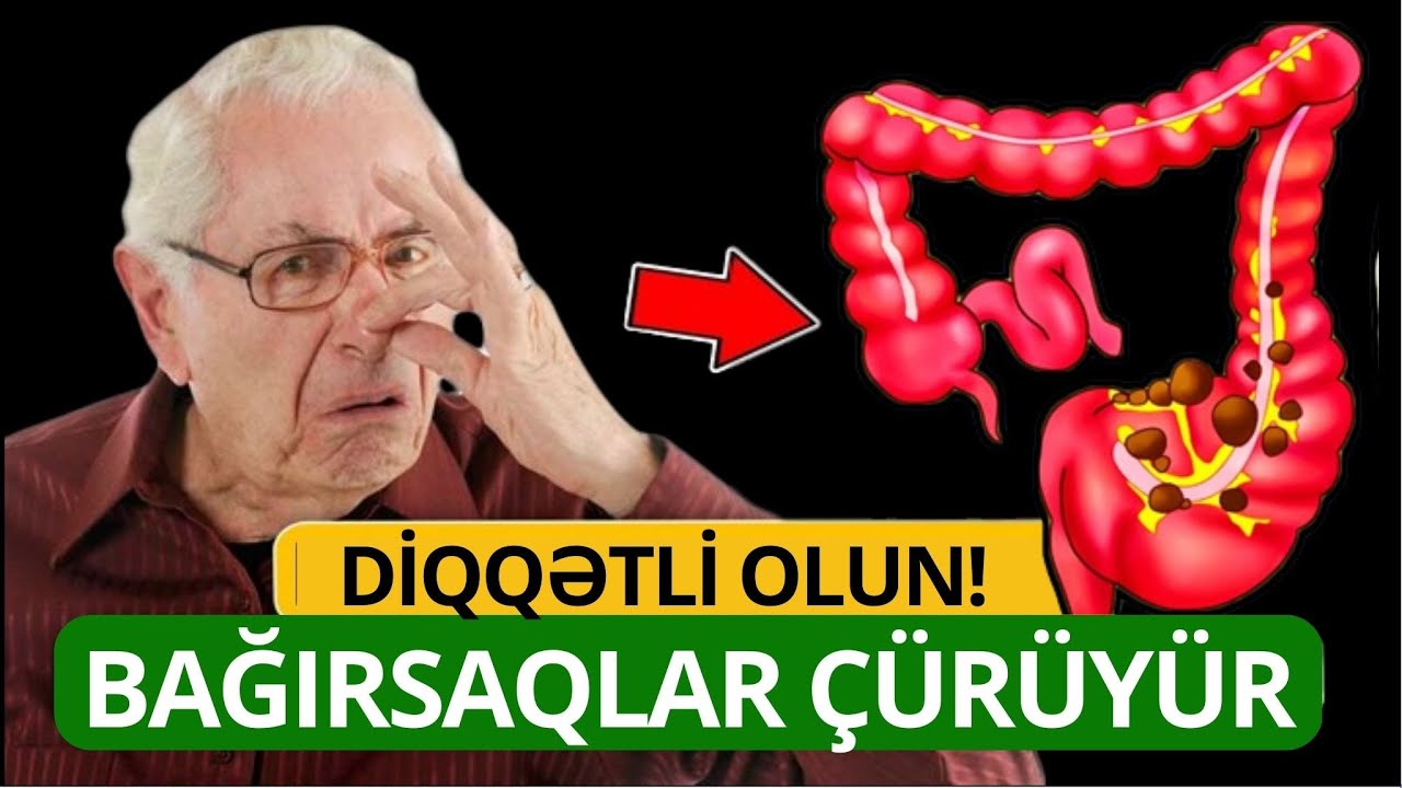 Bağırsaqların Çürüdüyü Göstərən 10 Əlamət! - İnsanların 90%i Bilmir
