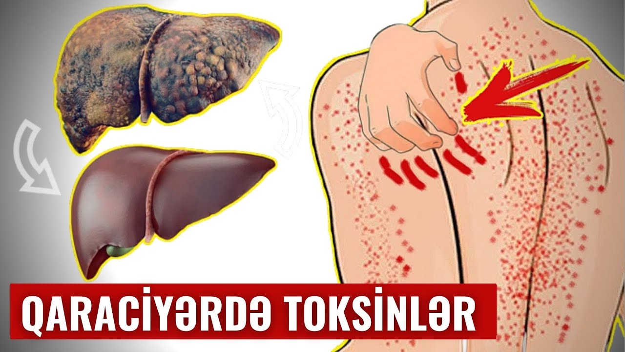 Qaraciyəri Piyləndirən Budur! - İnsanların 90%-i Bunu Bilmir